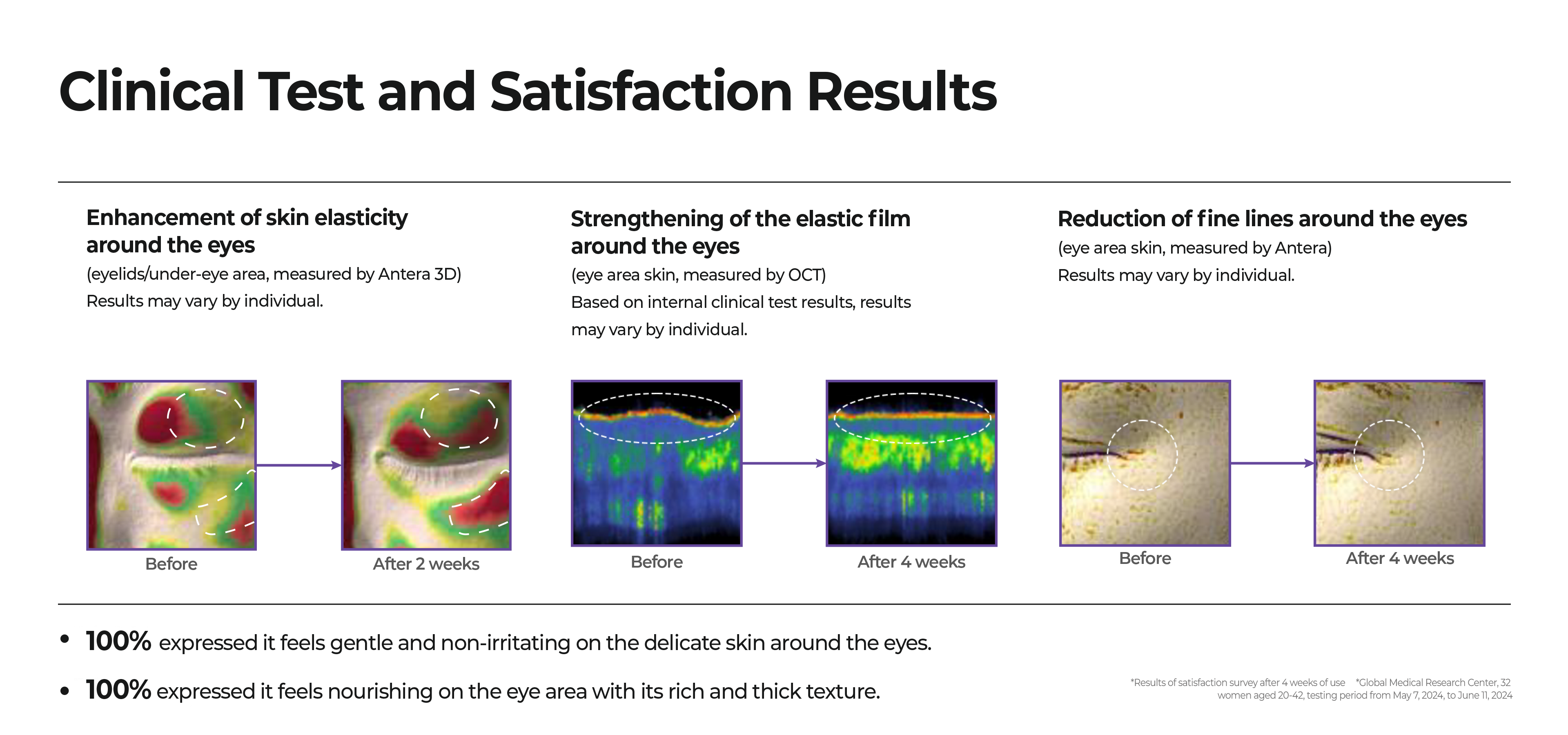 clinical test and satisfaction result, 100% expressed it feels gentle and non-irritating on the delicate skin around the eyes, 100% expressed it feels nourishing on the eye area with its rich and thick texture.