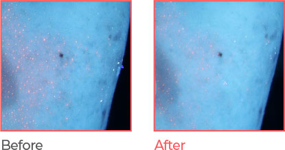 before & after